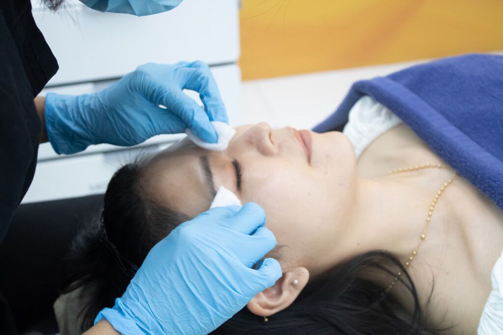 Halley Ultherapy PRIME(ウルセラ)リフトアップ